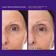 Load image into Gallery viewer, Lunar Bloom Retinal Serum
